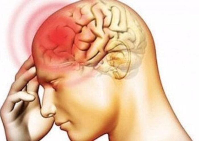 Meningitis