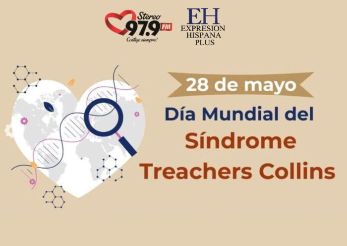 Sindrome de Treacher