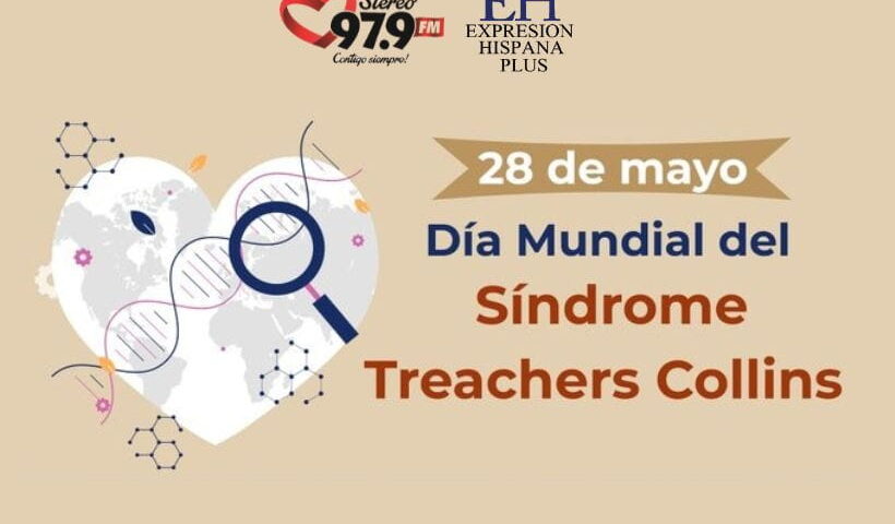 Sindrome de Treacher