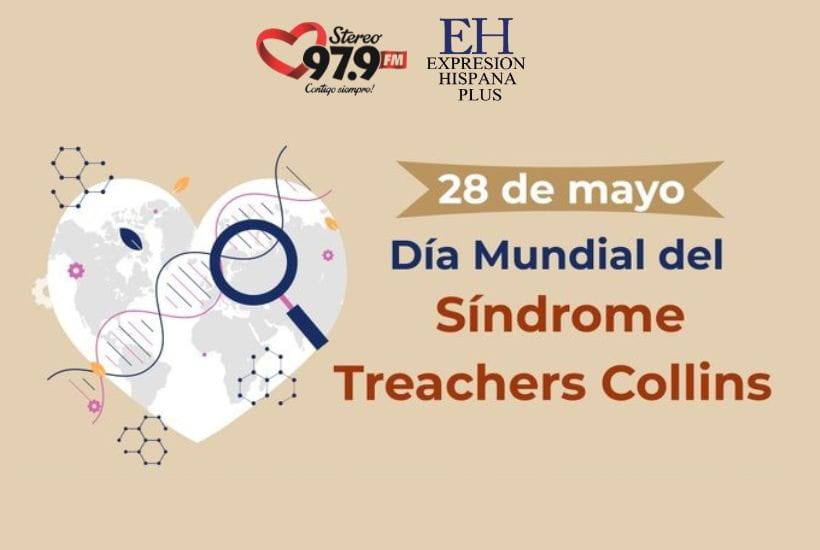 Sindrome de Treacher