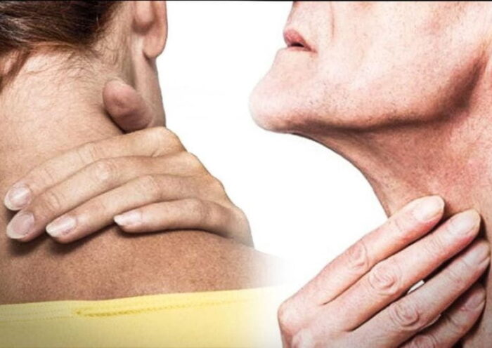 Cáncer de cabeza y cuello